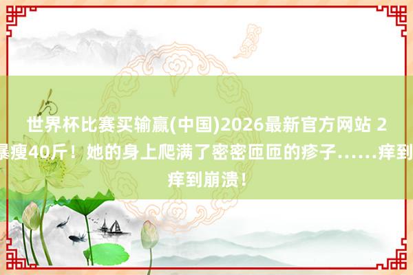 世界杯比赛买输赢(中国)2026最新官方网站 2个月暴瘦40斤！她的身上爬满了密密匝匝的疹子……痒到崩溃！